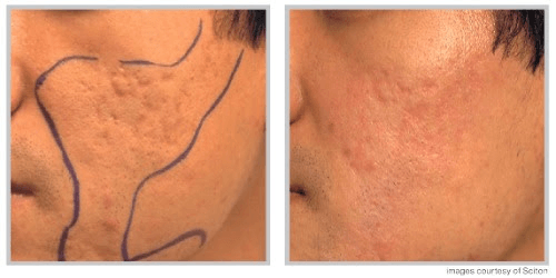 5 Things to Know About Scars 3 image 1