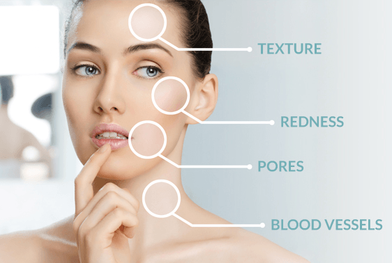 illuminator treatment Toronto