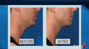 mens cosmetic treatments Toronto
