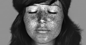 sun damage skin