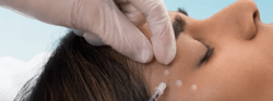 botox toronto