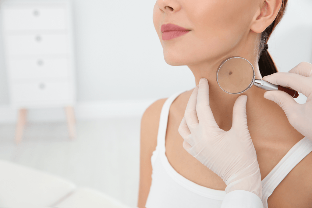 skin self exam Toronto dermatology