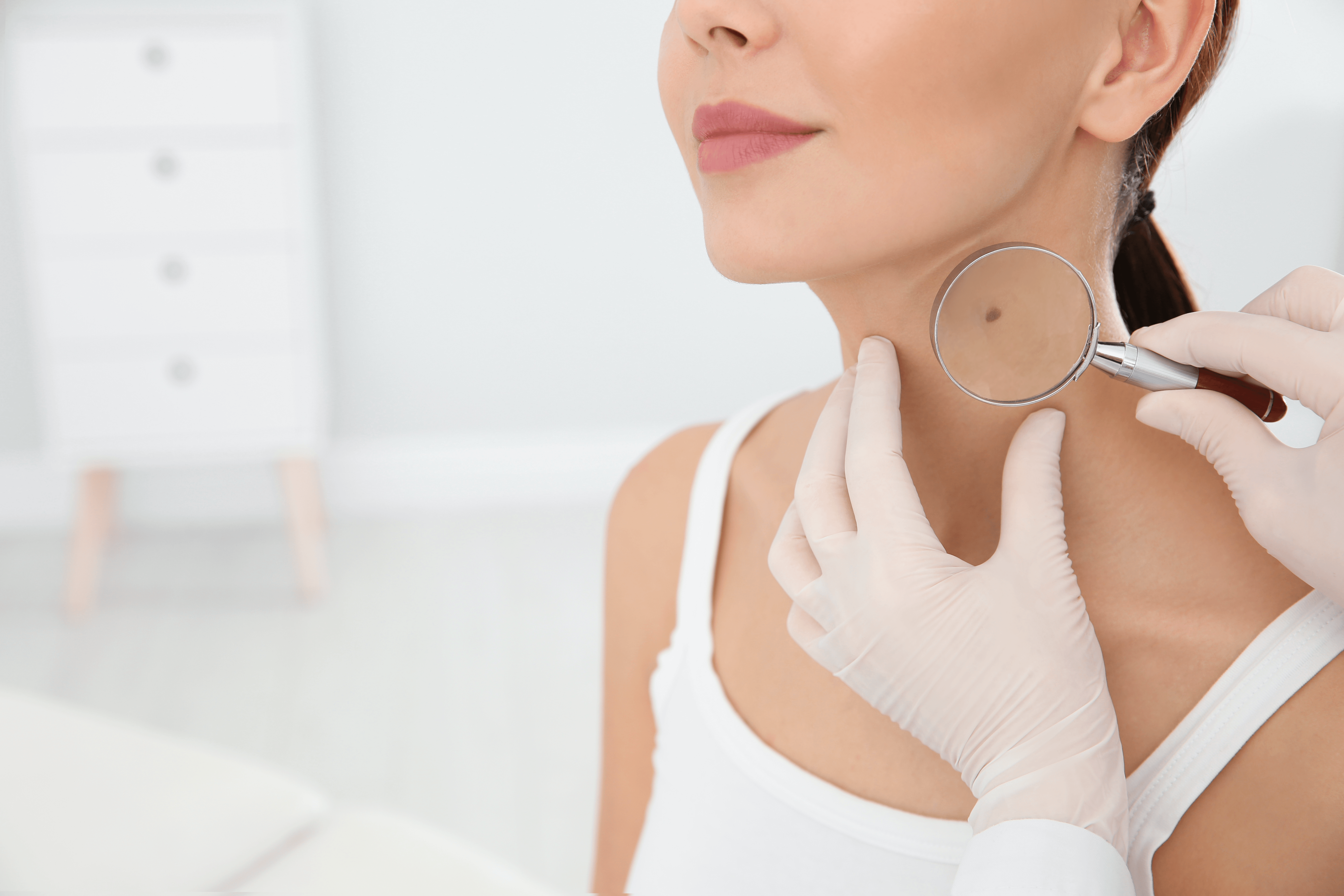 skin self exam Toronto dermatology
