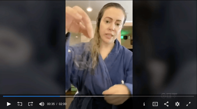 alyssa milano hair loss