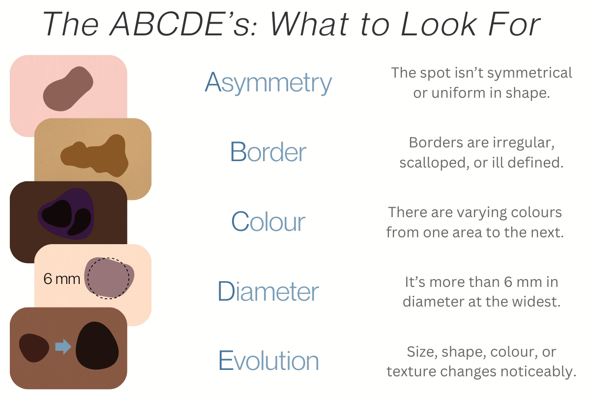 1. Asymmetry: The spot isn't symmetrical or uniform in shape. 
2. Border: Borders are irregular, scalloped, or ill defined. 
3. Colour: There are varying colours from one area to the next. 
4. Diameter: It's more than 6 mm in diameter at its widest. 
5. Evolution: Size, shape, colour, or texture changes noticeably over time. 