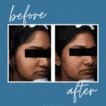 Let's Keep In Touch, Friend 3 Before and Afters